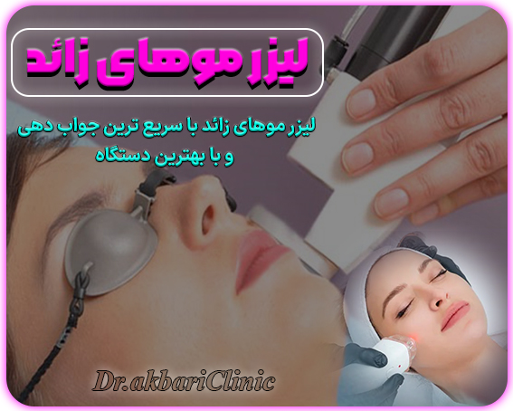 لیزر موهای زائد